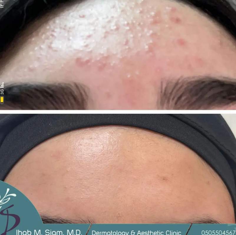 Dermatology | Dr. Ihab Siam