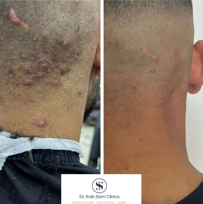 Dermatology | Dr. Ihab Siam
