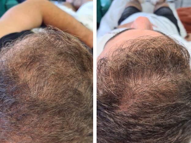 طب التجميل | الدكتور ألون شنايدر عيادة نورديكا