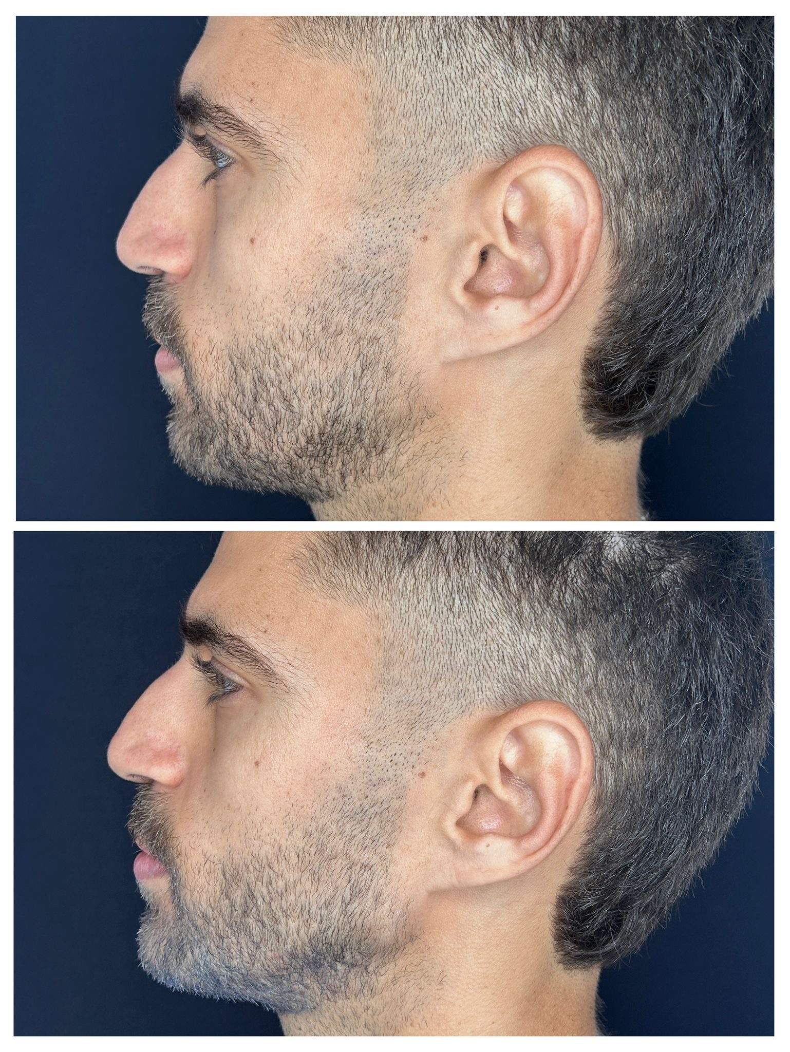 طب التجميل | الدكتور ألون شنايدر عيادة نورديكا