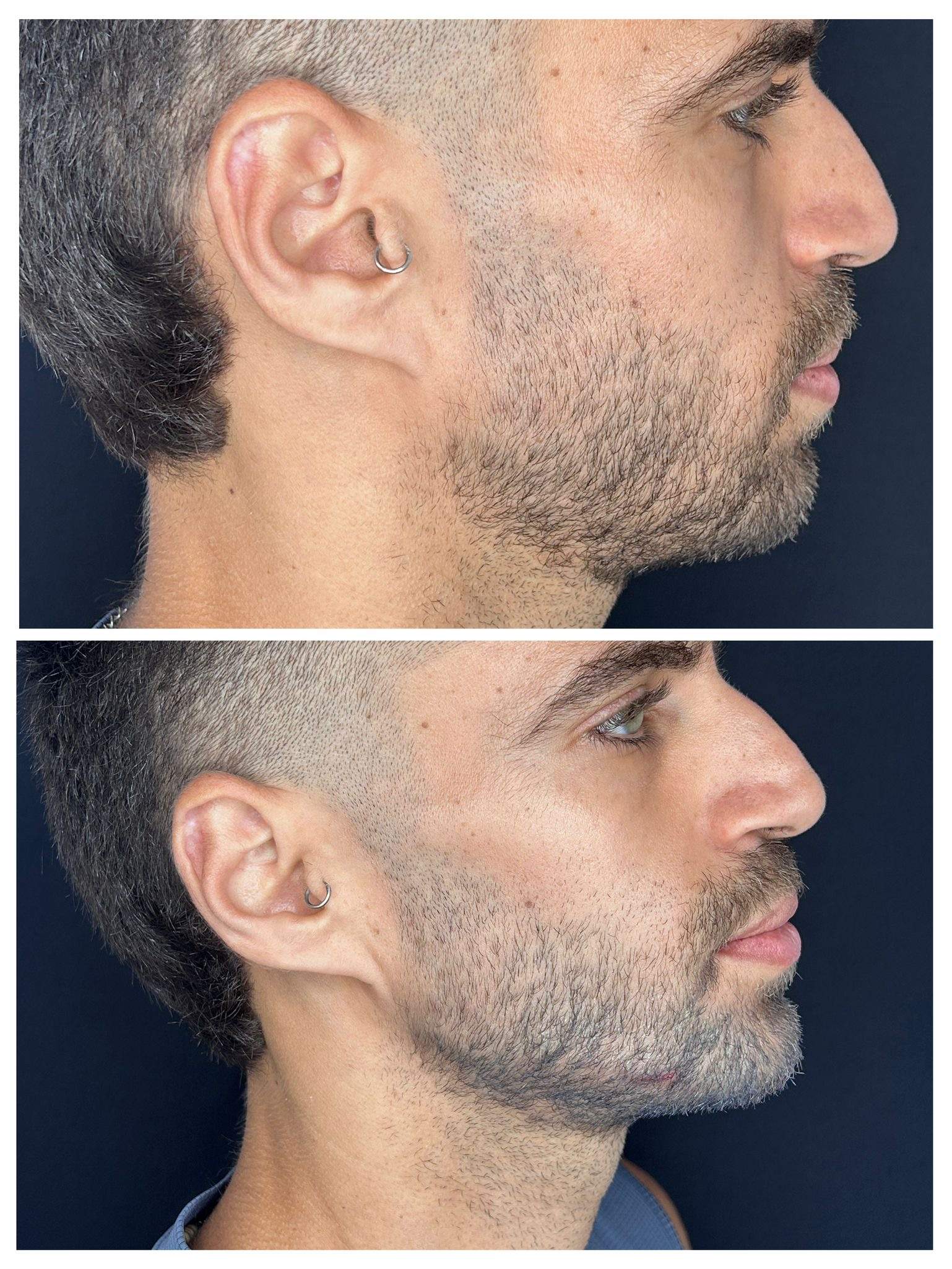 طب التجميل | الدكتور ألون شنايدر عيادة نورديكا