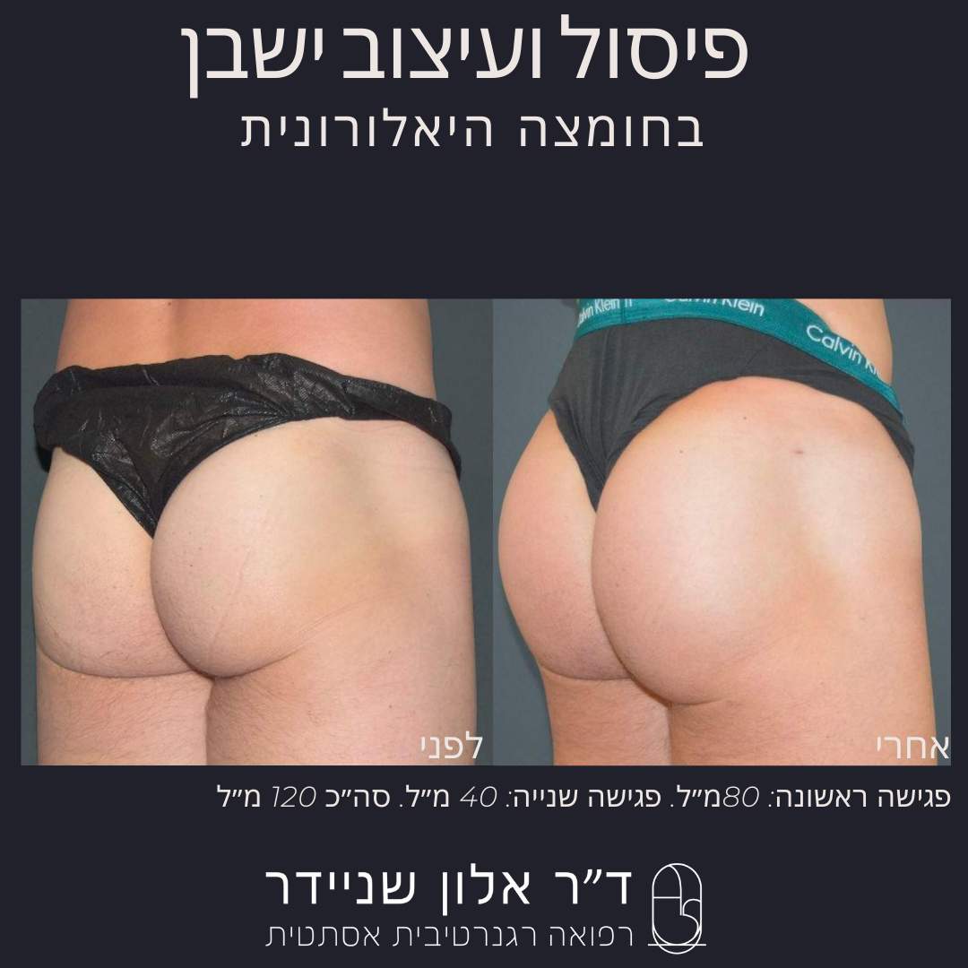 طب التجميل | الدكتور ألون شنايدر عيادة نورديكا