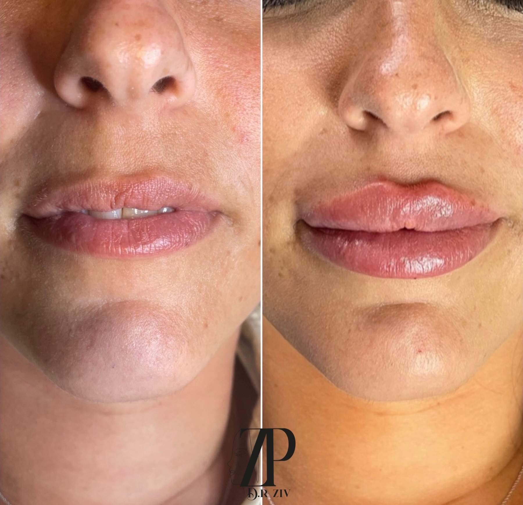 Aesthetic Medicine | Dr. Ziv Peretz