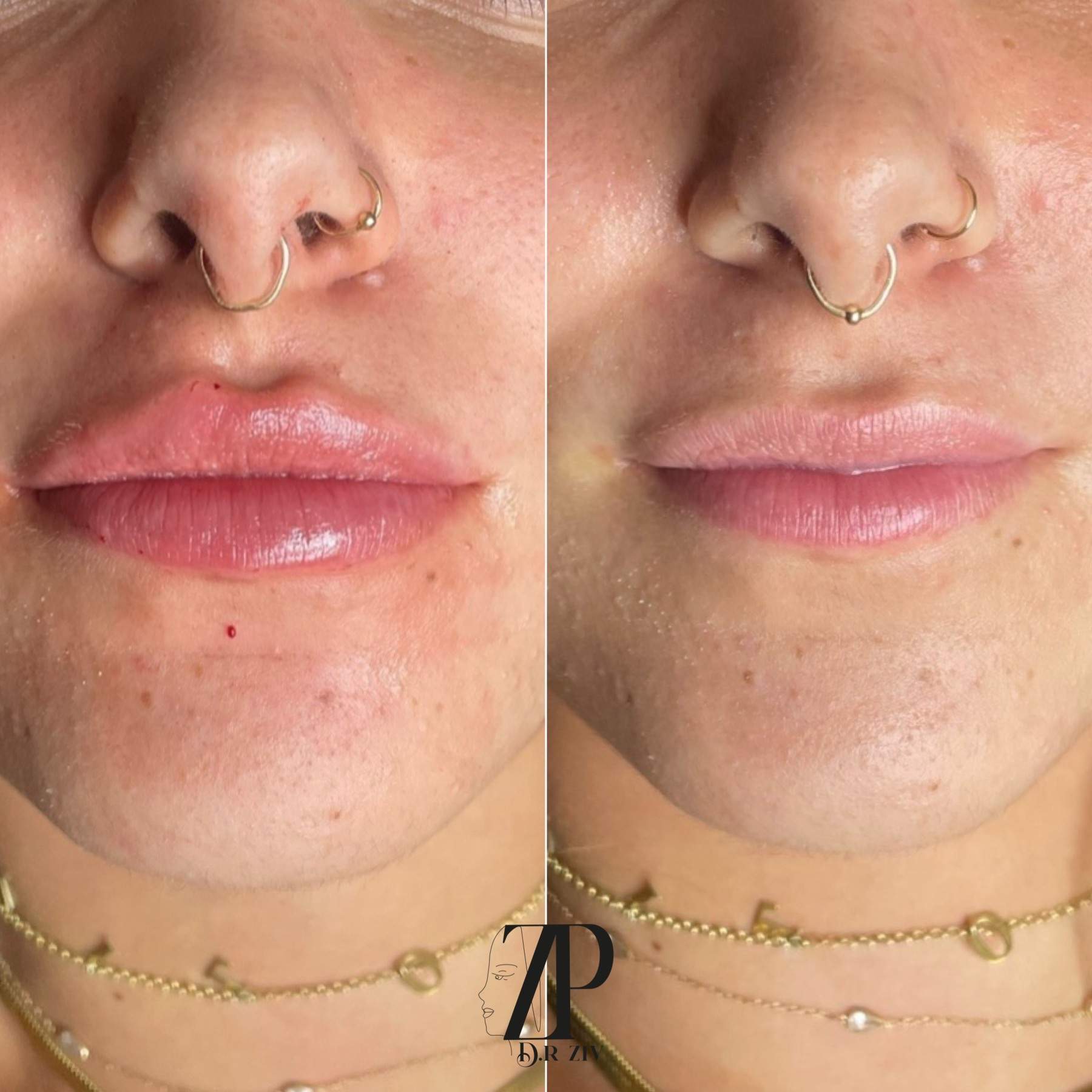 Aesthetic Medicine | Dr. Ziv Peretz