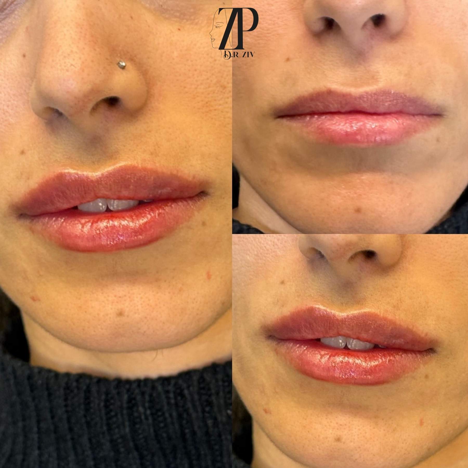 Aesthetic Medicine | Dr. Ziv Peretz