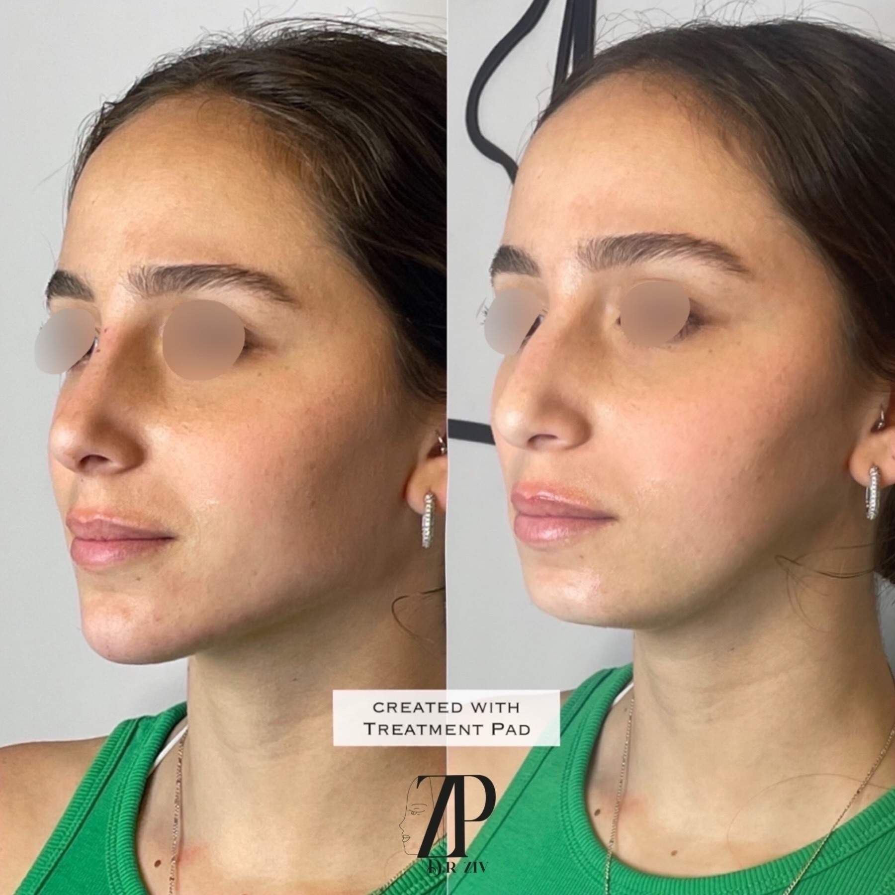 Aesthetic Medicine | Dr. Ziv Peretz