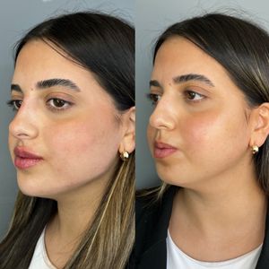 Aesthetic Medicine | Dr. Ziv Peretz