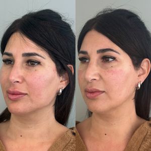 Aesthetic Medicine | Dr. Ziv Peretz