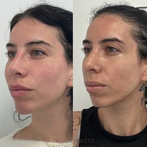 Aesthetic Medicine | Dr. Ziv Peretz