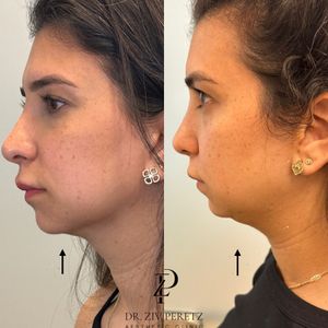 Aesthetic Medicine | Dr. Ziv Peretz