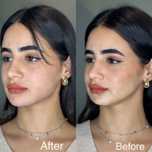 Aesthetic Medicine | Dr. Ziv Peretz