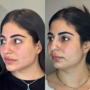 Aesthetic Medicine | Dr. Ziv Peretz