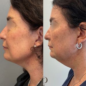 Aesthetic Medicine | Dr. Ziv Peretz
