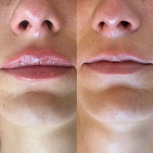 Aesthetic Medicine | Dr. Ziv Peretz
