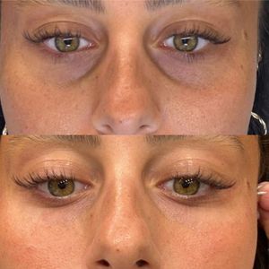 Aesthetic Medicine | Dr. Ziv Peretz