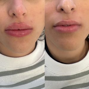 Aesthetic Medicine | Dr. Ziv Peretz