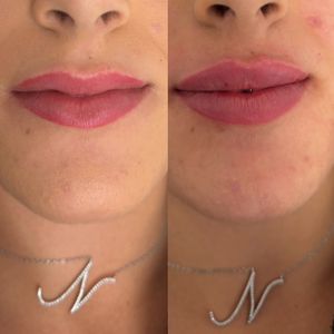 Aesthetic Medicine | Dr. Ziv Peretz