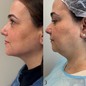 Aesthetic Medicine | Dr. Ziv Peretz