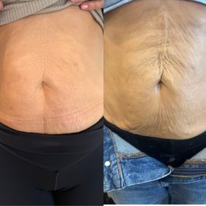 Aesthetic Medicine | Dr. Ziv Peretz