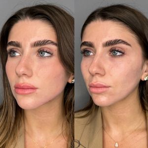 Aesthetic Medicine | Dr. Ziv Peretz