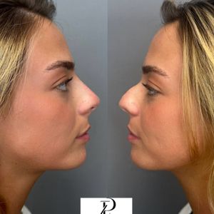 Aesthetic Medicine | Dr. Ziv Peretz