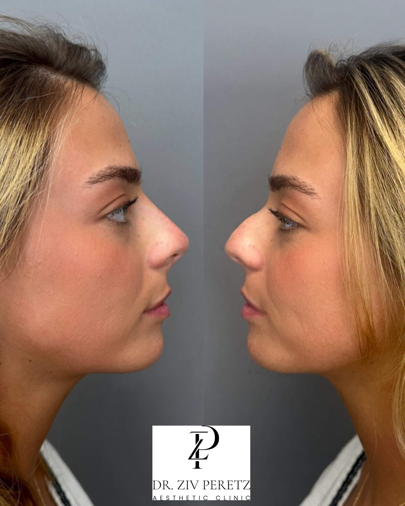 Aesthetic Medicine | Dr. Ziv Peretz