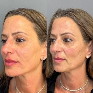 Aesthetic Medicine | Dr. Ziv Peretz