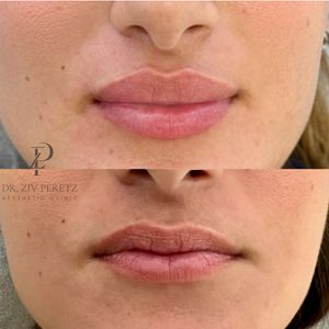 Aesthetic Medicine | Dr. Ziv Peretz
