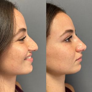 Aesthetic Medicine | Dr. Ziv Peretz