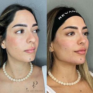 Aesthetic Medicine | Dr. Ziv Peretz