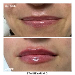 Aesthetic Medicine | Dr. Etai Beyar