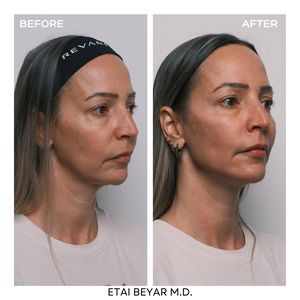 Aesthetic Medicine | Dr. Etai Beyar