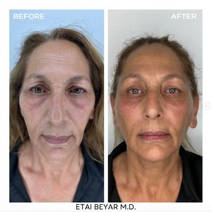 Aesthetic Medicine | Dr. Etai Beyar