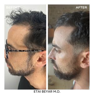 Aesthetic Medicine | Dr. Etai Beyar