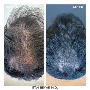 Aesthetic Medicine | Dr. Etai Beyar