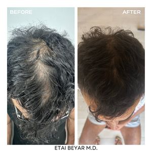 Aesthetic Medicine | Dr. Etai Beyar