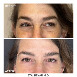 Aesthetic Medicine | Dr. Etai Beyar