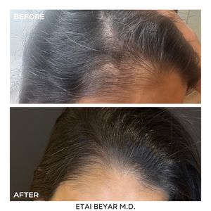 Aesthetic Medicine | Dr. Etai Beyar