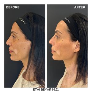 Aesthetic Medicine | Dr. Etai Beyar