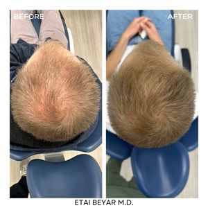 Aesthetic Medicine | Dr. Etai Beyar