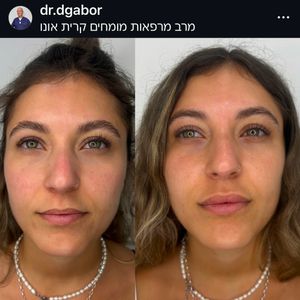 רפואה אסתטית | ד"ר דן גבור
