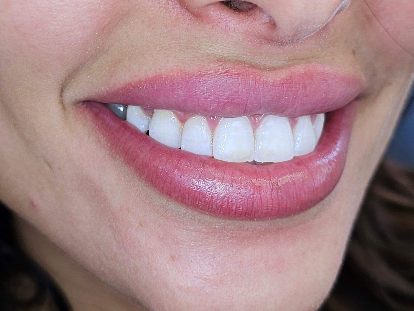 Dentistry | Dr. Gilad Fiskus