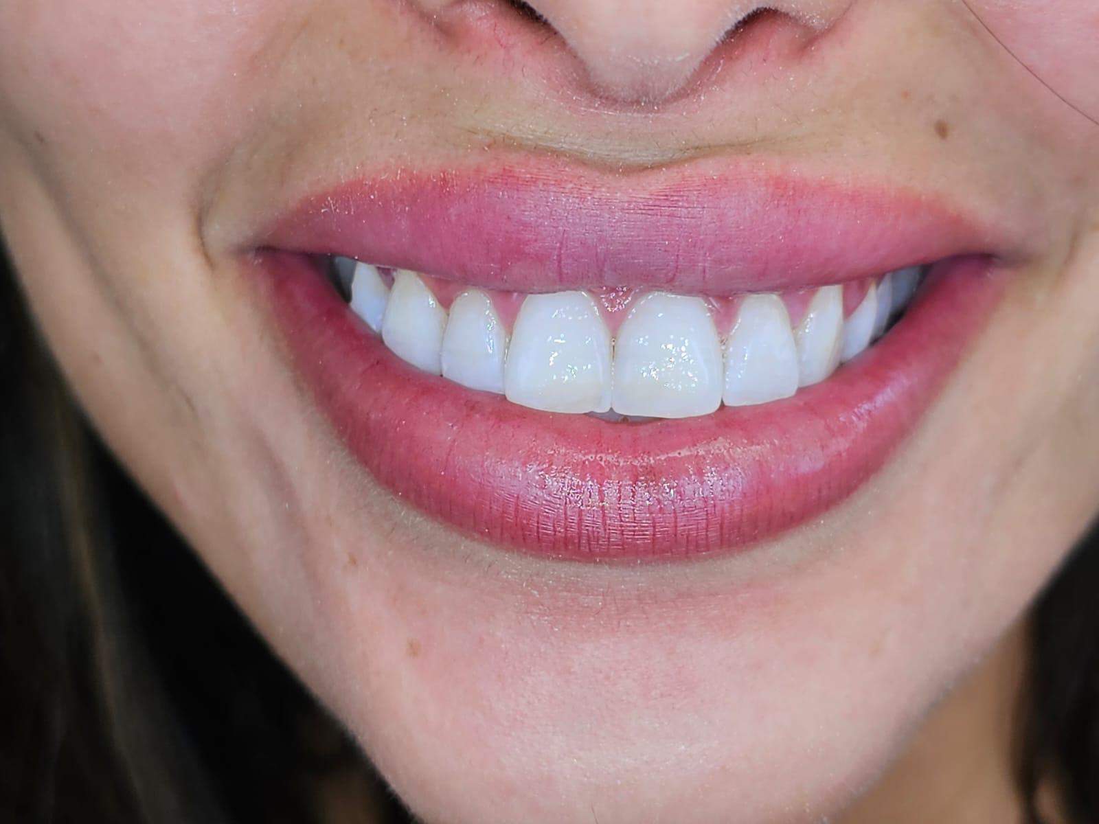Dentistry | Dr. Gilad Fiskus