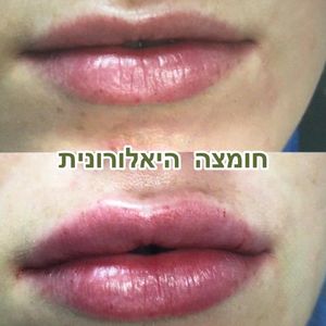 רפואת שיניים | ד"ר נינו שפוליאנסקי-נוגאידלי