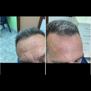 רפואת שיניים | ד"ר נינו שפוליאנסקי-נוגאידלי