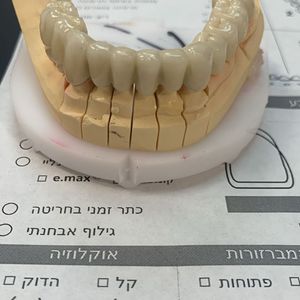 רפואת שיניים | ד"ר אריק מובשוביץ