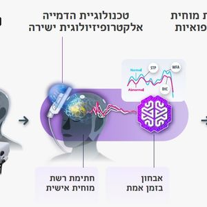 בדיקת דלפי Delphi-MD: אופן פעולה