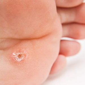 Podiatry | Irma van de Visch