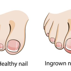 Podiatry | Irma van de Visch