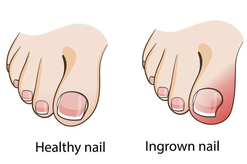 Podiatry | Irma van de Visch